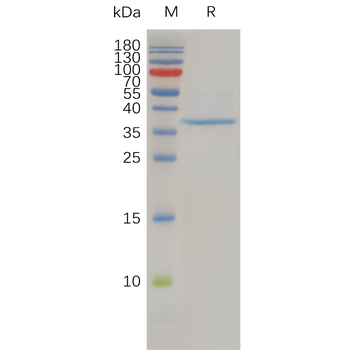 Human TIGIT Protein, mFc Tag