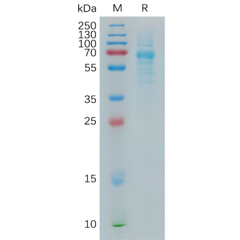 Human TIGIT Protein, His Tag