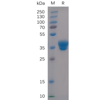 Human IL6R Protein, His Tag