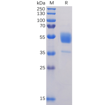 Human CD171 Protein, His Tag
