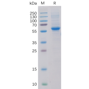 Human HVEM Protein, His Tag