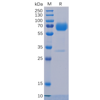 Human CD44 Protein, His Tag