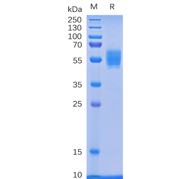 Human VEGFA Protein, His Tag