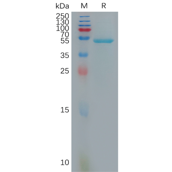 Human PDL2 Protein, His Tag