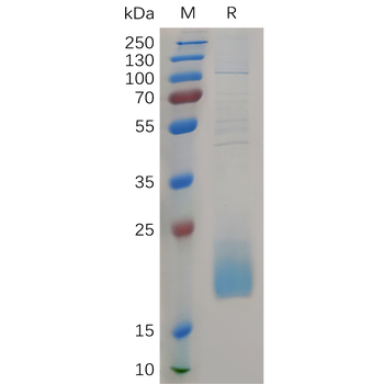 Human CD56 Protein, His Tag