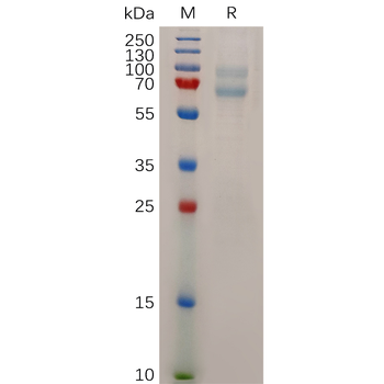 Human SIRPa Protein, mFc Tag