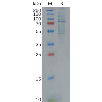 Human IL5RA Protein, hFc Tag