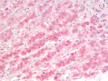 SLC40A1/Ferroportin-1 Antibody