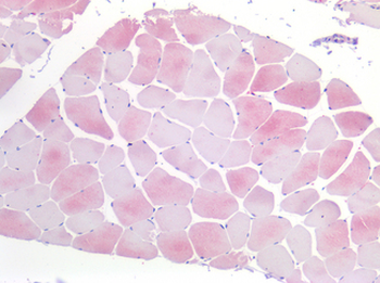 IL6R/IL6 Receptor Antibody