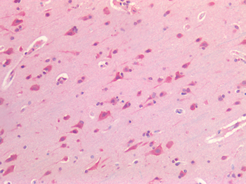PDGFRA/PDGFR Alpha Antibody