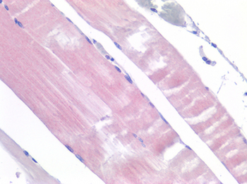 IL6R/IL6 Receptor Antibody