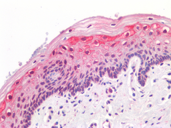 GREM1/Gremlin-1 Antibody
