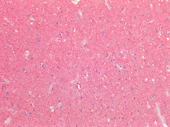 TTR/Transthyretin Antibody