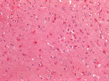 TTR/Transthyretin Antibody