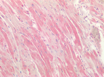 CTSK/Cathepsin K Antibody