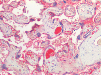 EBI3/IL-27B Antibody