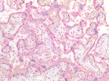 EBI3/IL-27B Antibody