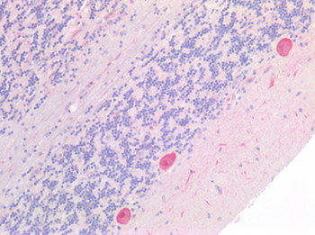 ATG16L1/ATG16L Antibody
