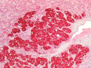 CDH3/P-Cadherin Antibody