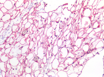 IL6/Interleukin 6 Antibody