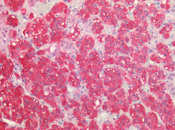 P2RX3/P2X3 Antibody
