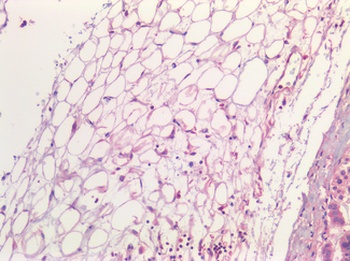 IL6/Interleukin 6 Antibody