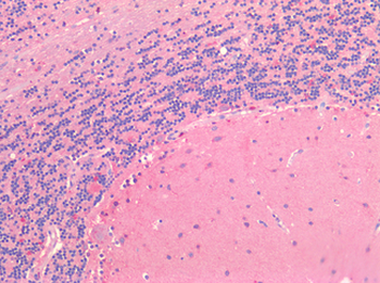 CX3CL1/Fractalkine Antibody