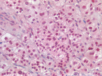 ARID1A/BAF250 Antibody