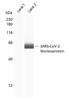 SARS-CoV-2 Nucleoprotein Antibody