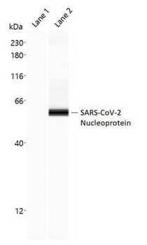 SARS-CoV-2 Nucleoprotein Antibody