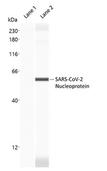 SARS-CoV-2 Nucleoprotein Antibody