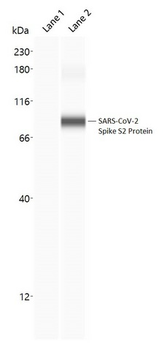 SARS-CoV-2 Spike Glycoprotein Antibody