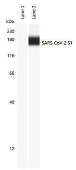 SARS-CoV-2 Spike Glycoprotein Antibody