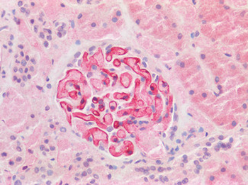 TMPRSS2/Epitheliasin Antibody