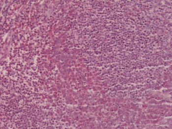 CCR2 Antibody