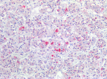 GnRH receptor/GNRHR Antibody