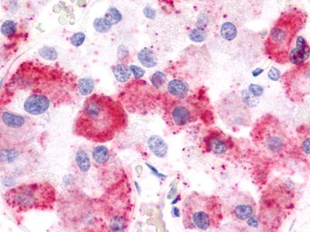 LPAR1/LPA1/EDG2 Antibody