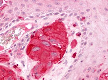 LPAR1/LPA1/EDG2 Antibody