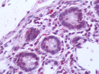 NR5A2/LRH-1 Antibody