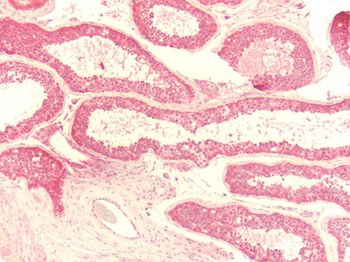 ADGRE1/EMR1 Antibody