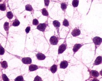 GRM3/MGLUR3 Antibody