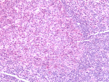 CCR7 Antibody