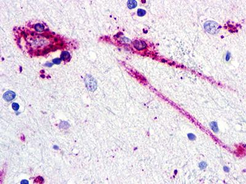 C5AR2/GPR77/C5L2 Antibody
