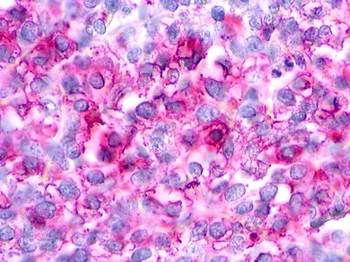 CHEMR23/CMKLR1 Antibody
