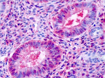 ESRRB/ERR Beta Antibody