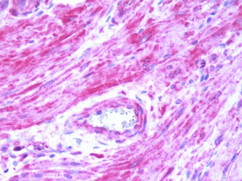 BDKRB2/Bradykinin B2 Receptor Antibody