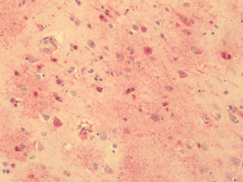 ADGRG1/GPR56 Antibody