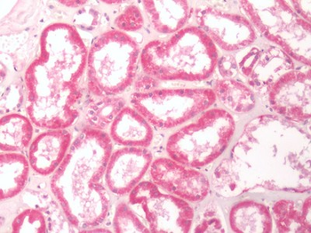 TRPA1 Antibody