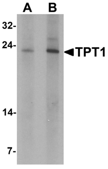 TPT1/TCTP Antibody