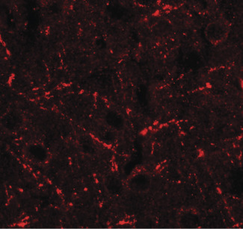 CCL4/MIP-1 Beta Antibody